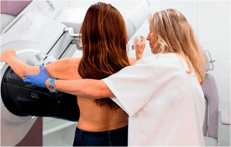 Canarie lo screening per il cancro al seno rileva 596 tumori su 110 mila mammografie in un anno